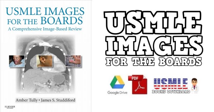 USMLE Images for the Boards PDF