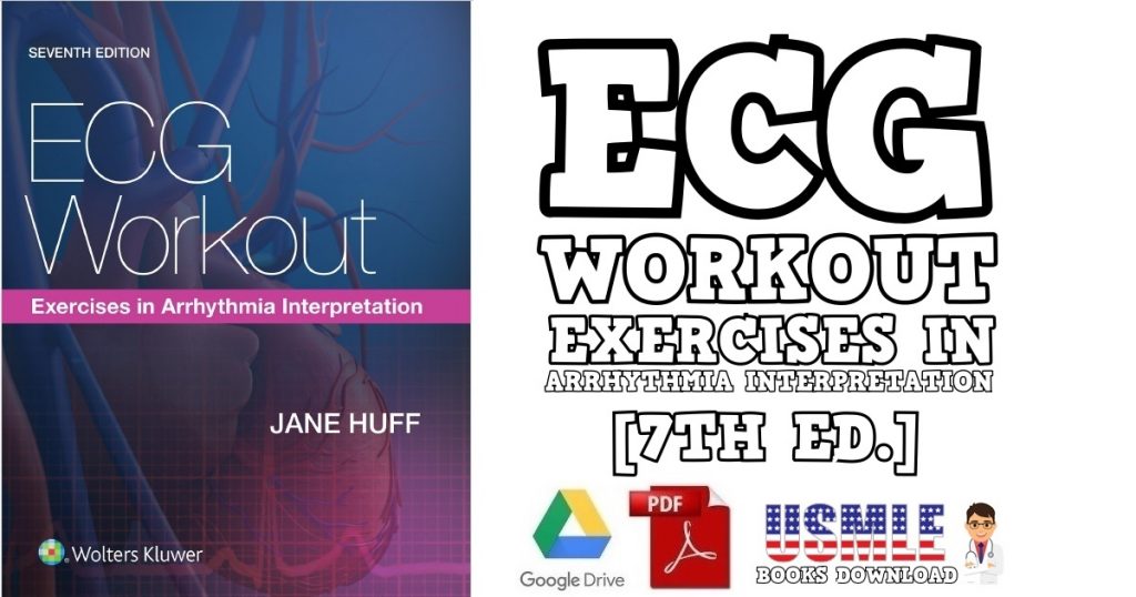 Best Ecg workout exercises in arrhythmia interpretation 7th edition pdf for Beginner
