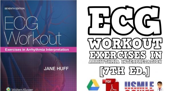 30 Minute Ecg workout exercises in arrhythmia interpretation 7th edition pdf 