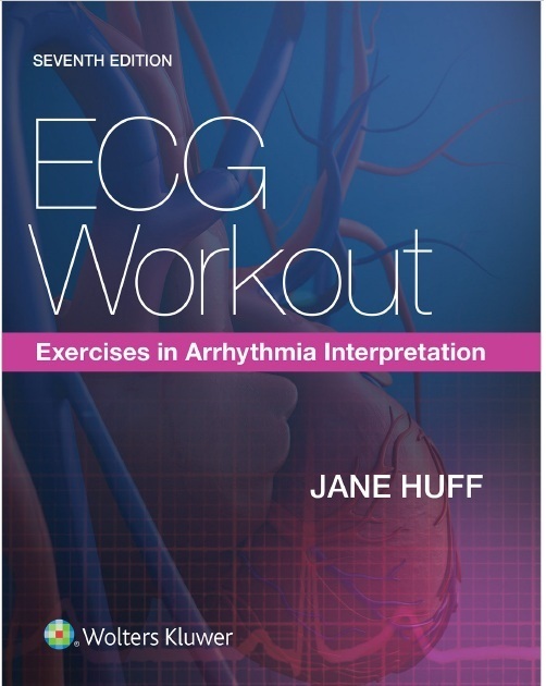 ECG Workout: Exercises in Arrhythmia Interpretation PDF