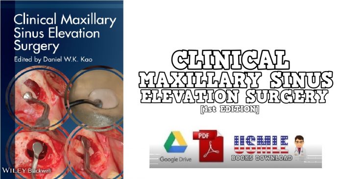 Clinical Maxillary Sinus Elevation Surgery 1st Edition PDF Free Download