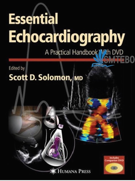 Echocardiography Handbook: A Practical Casebook PDF 