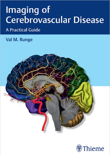 Imaging of Cerebrovascular Disease: A Practical Guide 1st Edition PDF 