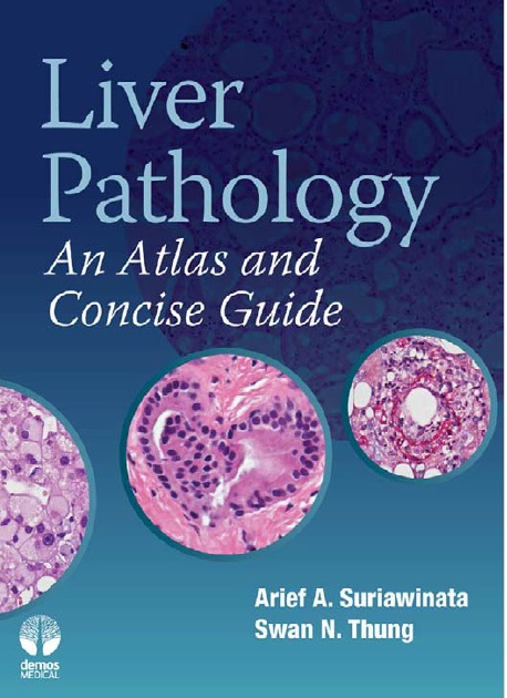 Liver Pathology: An Atlas and Concise Guide 1st Edition PDF 