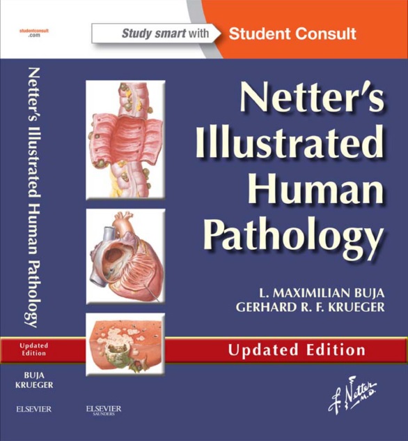 Netter's Illustrated Human Pathology E-book with Student Consult Access 1st Edition PDF