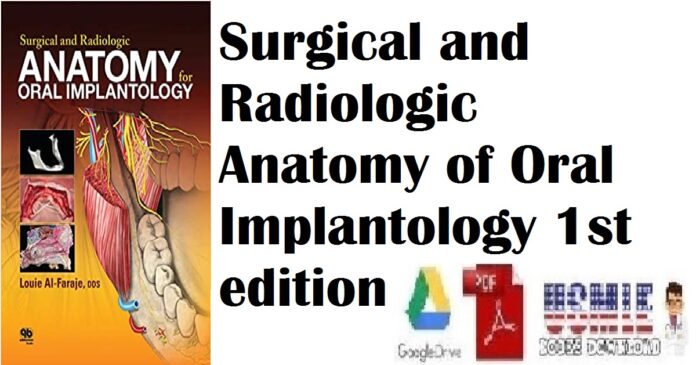 Surgical and Radiologic Anatomy of Oral Implantology 1st edition PDF Free Download