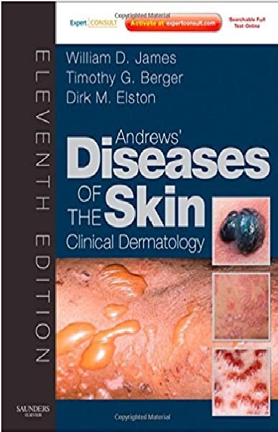 Andrews' Diseases of the Skin: Clinical Dermatology (Expert Consult) 11th Edition PDF