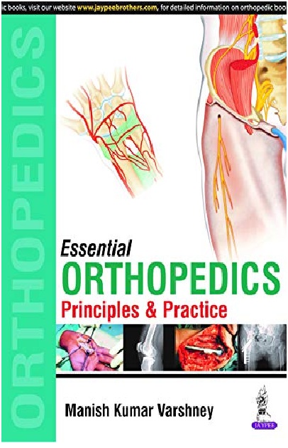 Essentials Orthopedics (Principles and Practice) 1st Edition PDF