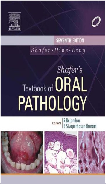 Shafer's Textbook of Oral Pathology 7th Edition PDF